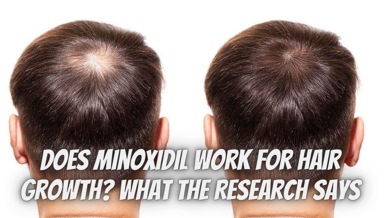 Does Minoxidil Work for Hair Growth What the Research Says