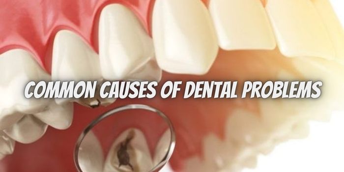 What are the common causes of dental problems?